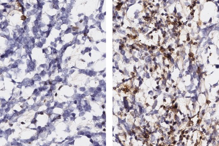Two side‑by‑side microscopy images showing tissue samples with differing staining patterns.