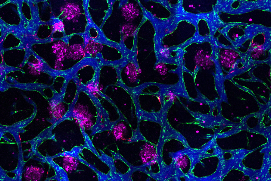 Fluorescent microscopy image of interconnected blue and green structures with clusters of bright pink spots.