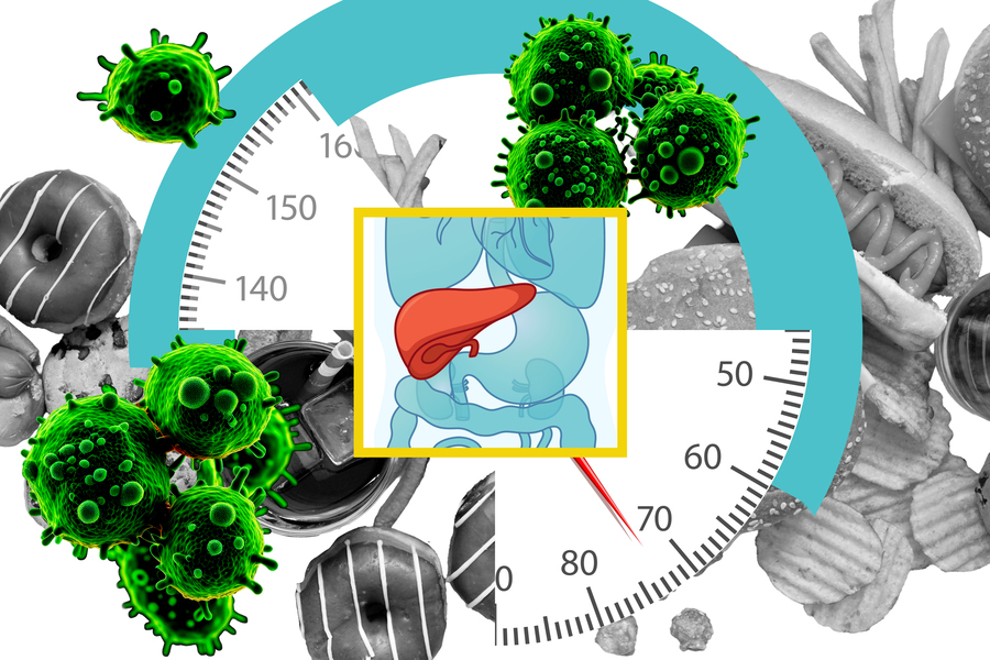 Conceptual graphic showing cancer cells, unhealthy foods, and a highlighted pancreas over a gauge-like backdrop.